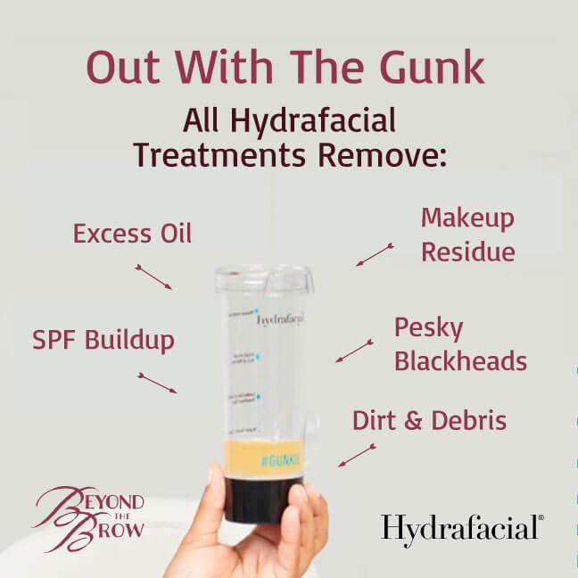 Achieving Clear Skin: How HydraFacial Improves Acne and Acne Scarring